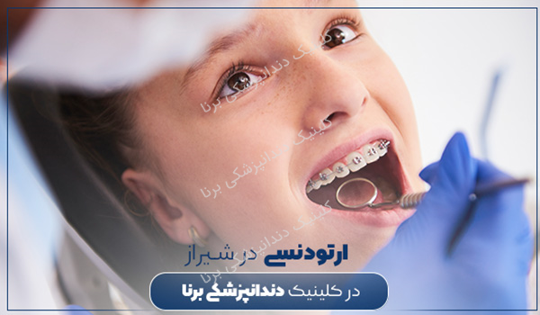 ارتودنسی دندان ثابت و متحرک در بهترین کلینیک دندانپزشکی در شیراز